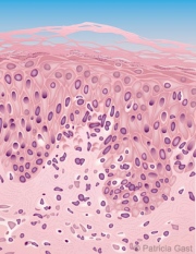 Dermatopathology