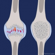 Knee Joint Pathology 2